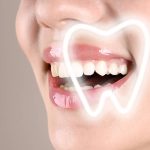 MND Dental: Kako do belih zuba