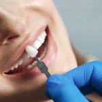 3 načina da sačuvate svoje zube kod zubara