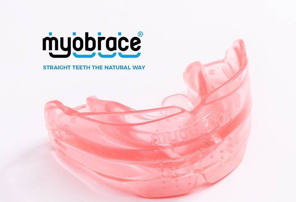 MND Dental: Revolucionarni Myobrace sistem pomaže zubima čak i u doba krize