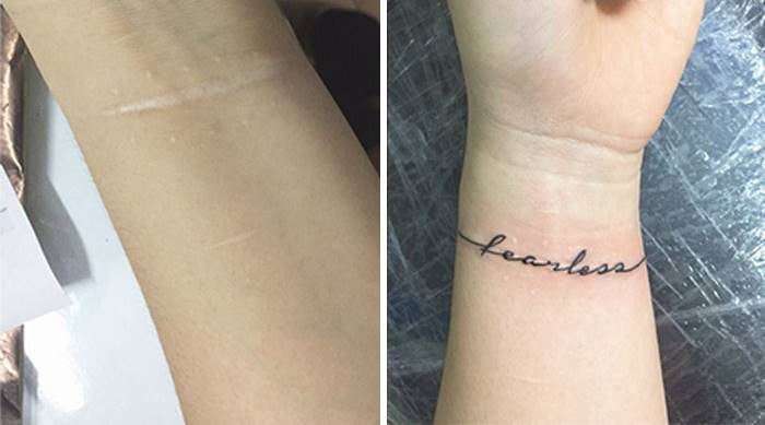 Vijetnamka tetovažama pokriva ožiljke na savršen način