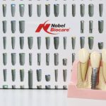 Ugradite zubne implante u ordinaciji MND Dental