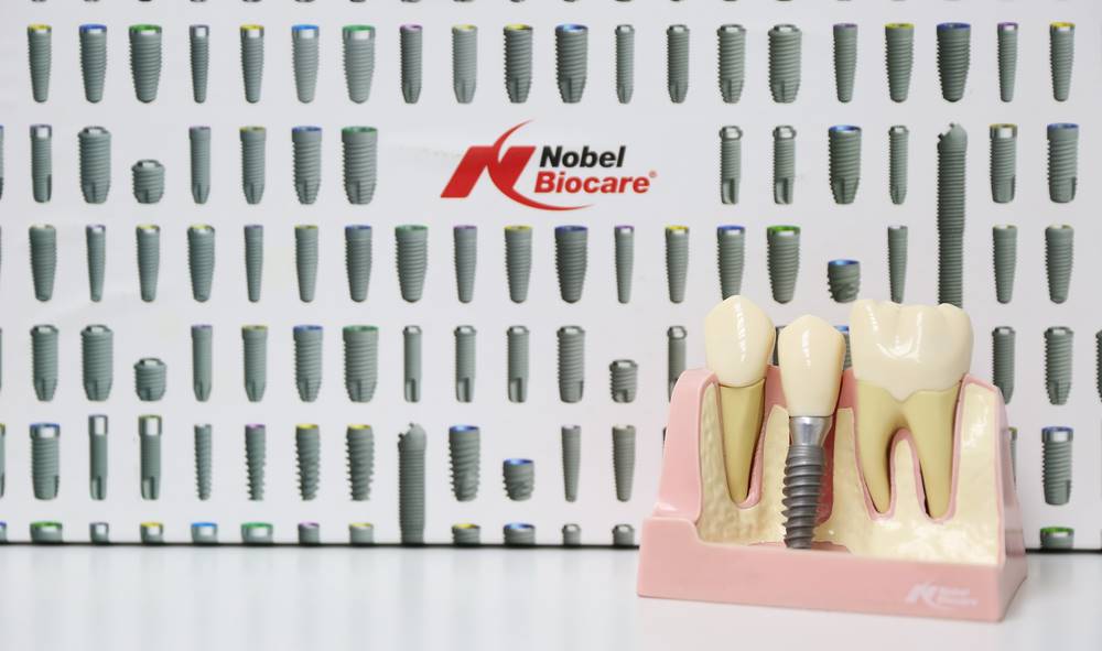 Ugradite zubne implante u ordinaciji MND Dental