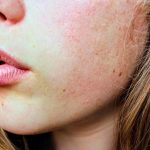 5 aktivnosti koje nam isušuju kožu