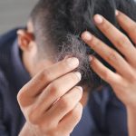 7 mogućih razloga zbog kojih vam opada kosa
