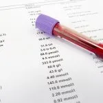 Tumačenje kompletne krvne slike (KKS) za početnike: Vodič kroz skraćenice i normalne referentne vrednosti