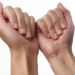 Vesnici potencijalnih zdravstvenih problema: Linije na noktima ne smete ignorisati, a evo šta vam telo poručuje