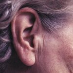 Šta znači kada vam uši sa godinama postaju veće