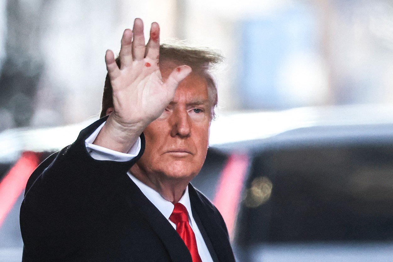 Šta se događa sa rukama Donalda Trampa? Svi gledaju u čudne crvene fleke, evo šta bi mogao da bude uzrok