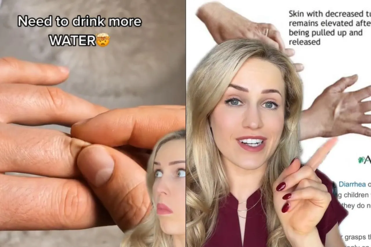 Viralni TikTok trik: Evo kako ćete otkriti da li ste dehidrirani!