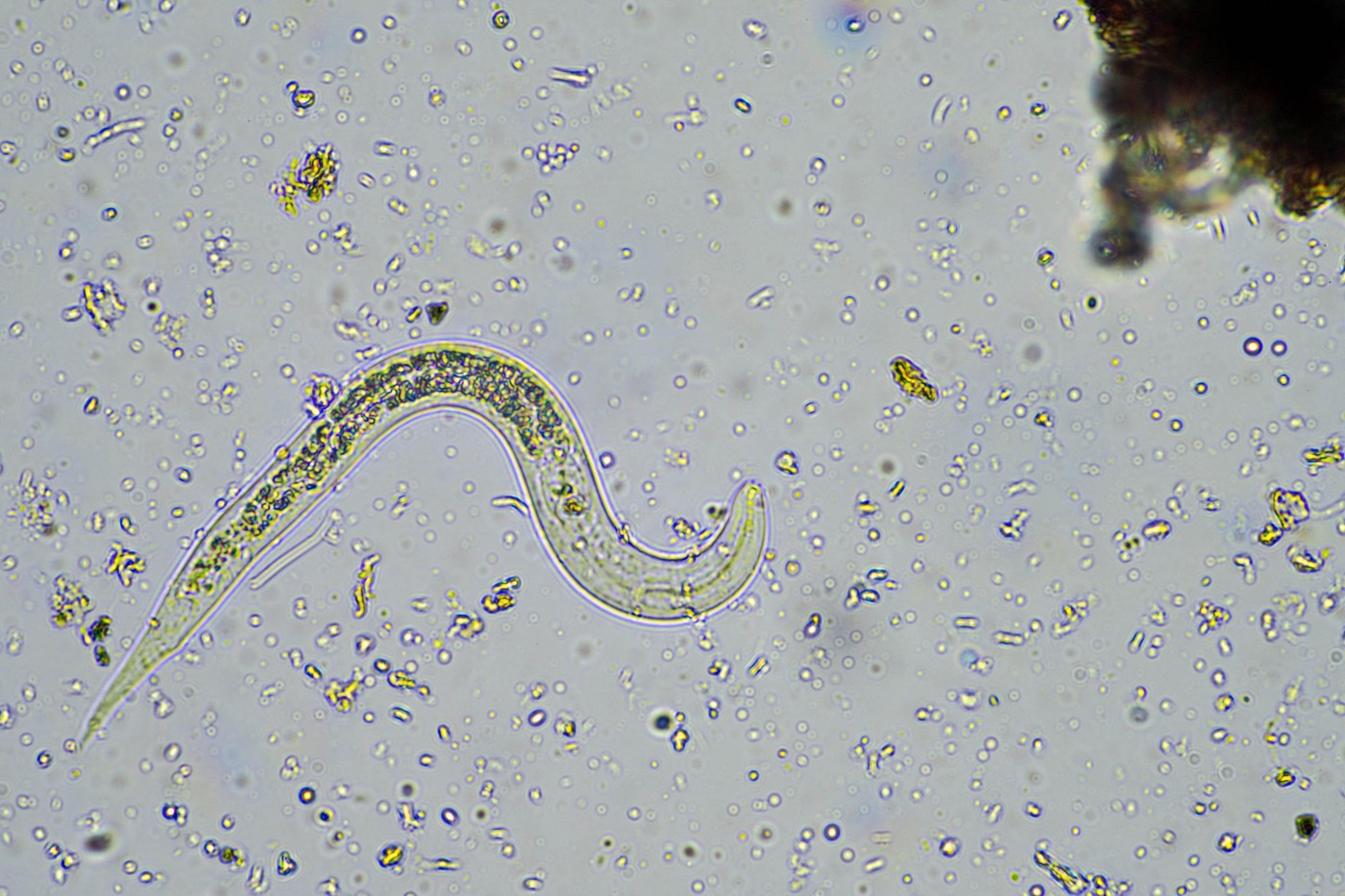 Nematode: Valjkasti crvi čiji je primarni domaćin čovek