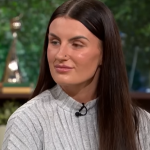 Devojka (24) alergična je na vodu: Znojenje i tuširanje izazivaju joj bol i osip