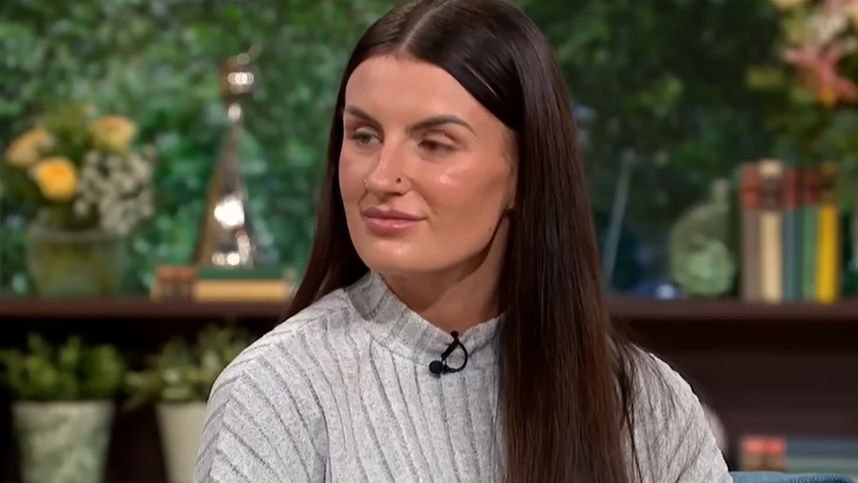 Devojka (24) alergična je na vodu: Znojenje i tuširanje izazivaju joj bol i osip